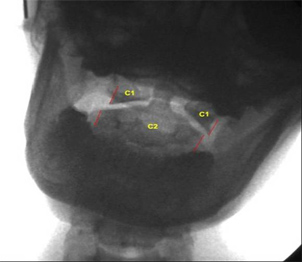 Image - Lateral Translation of C1 Mass on C2