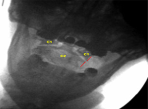 Image - Normal Open Mouth