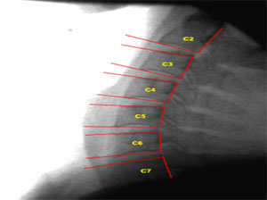 Image - Normal Extension